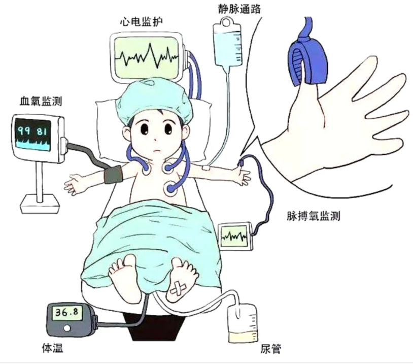 全麻后脑子会变傻吗？