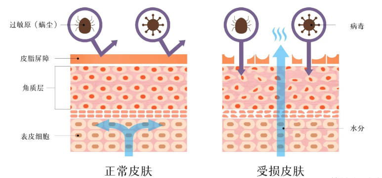 皮肤病喝中药的禁忌