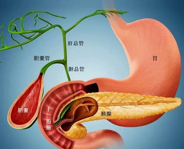 做完ERCP后多久切除胆囊