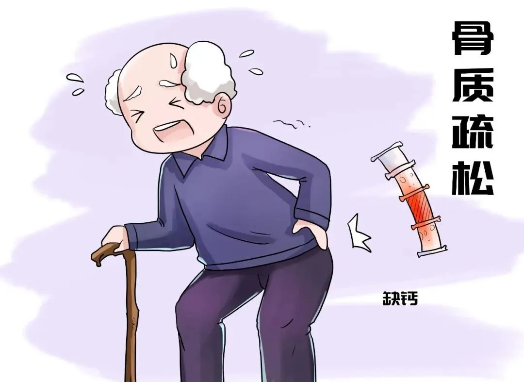 骨质疏松怎样治疗最好有什么症状表现|骨质疏松不能治愈但可以预防，早期筛查是关键！