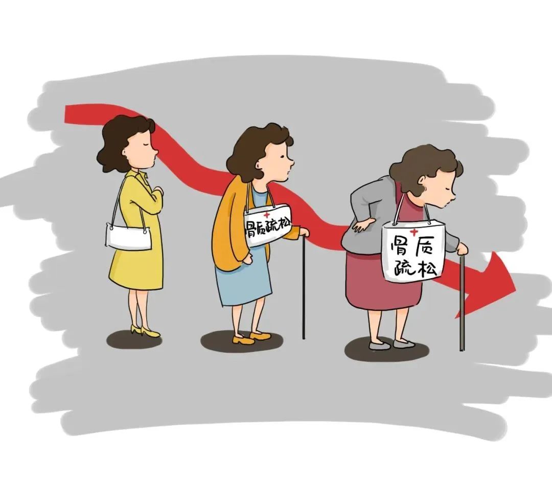 骨质疏松怎样治疗最好有什么症状表现|骨质疏松不能治愈但可以预防，早期筛查是关键！