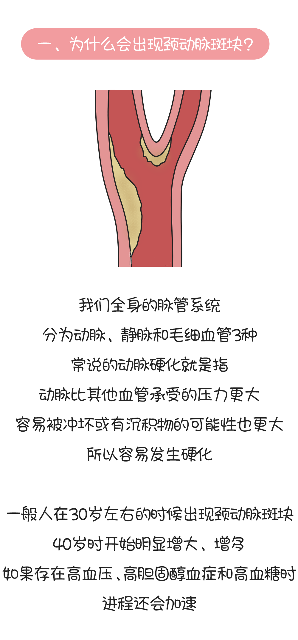 40岁上每个人都有颈动脉斑块?需要治疗吗|查出颈动脉斑块后，有个动作最好立马停止!