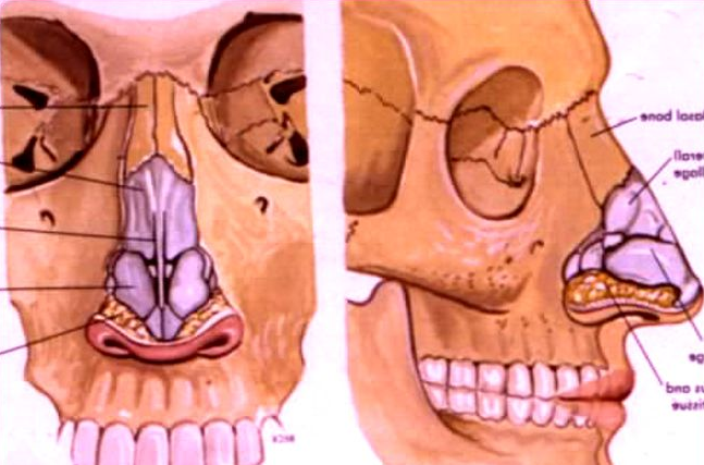 治疗双侧鼻骨和鼻中隔骨折医院