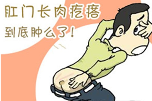 肛门长了个包你知道怎么回事吗？川北医学院附属成都新华医院为你揭开真相