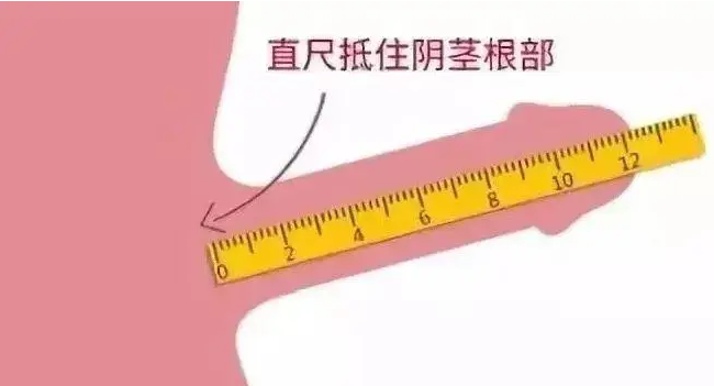 男性阴茎一般多少厘米算正常?男人阴茎正常是多少厘米?